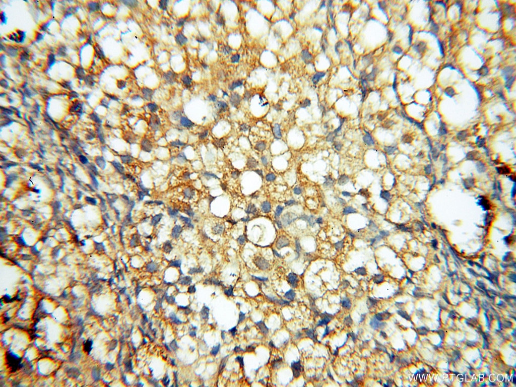 Immunohistochemistry (IHC) staining of human ovary tissue using PTPN14 Polyclonal antibody (18053-1-AP)