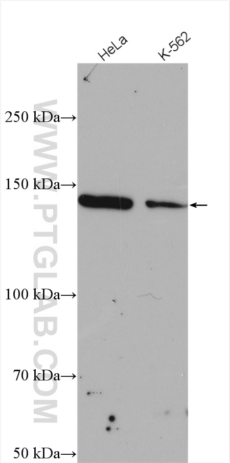 Western Blot (WB) analysis of various lysates using PTPN14 Polyclonal antibody (18053-1-AP)