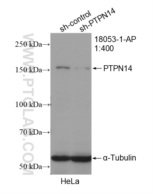Western Blot (WB) analysis of HeLa cells using PTPN14 Polyclonal antibody (18053-1-AP)