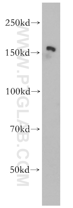 Western Blot (WB) analysis of HeLa cells using PTPN14 Polyclonal antibody (18053-1-AP)