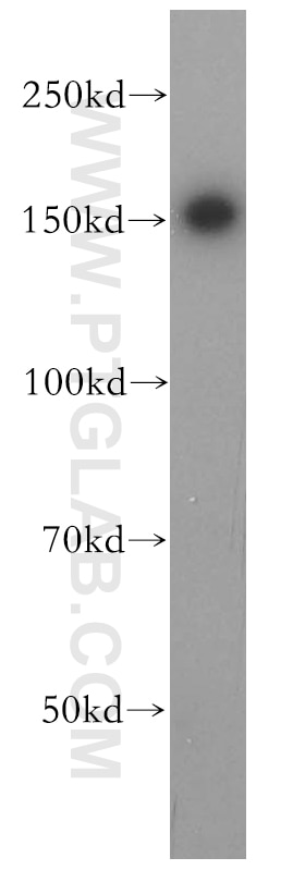 Western Blot (WB) analysis of K-562 cells using PTPN14 Polyclonal antibody (18053-1-AP)