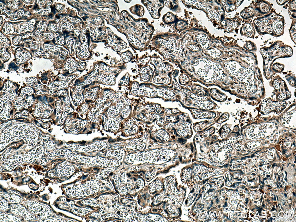 Immunohistochemistry (IHC) staining of human placenta tissue using PTPN14 Monoclonal antibody (67744-1-Ig)