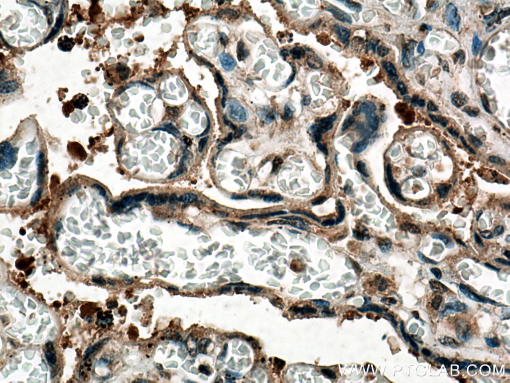 Immunohistochemistry (IHC) staining of human placenta tissue using PTPN14 Monoclonal antibody (67744-1-Ig)