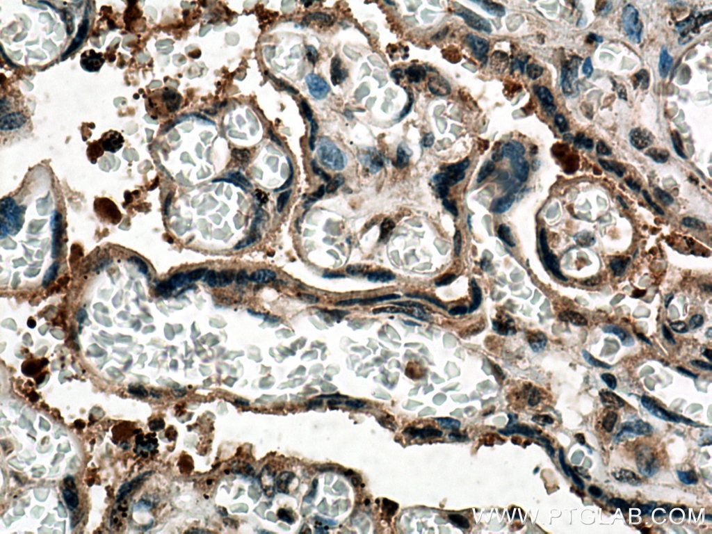 IHC staining of human placenta using 67744-1-Ig