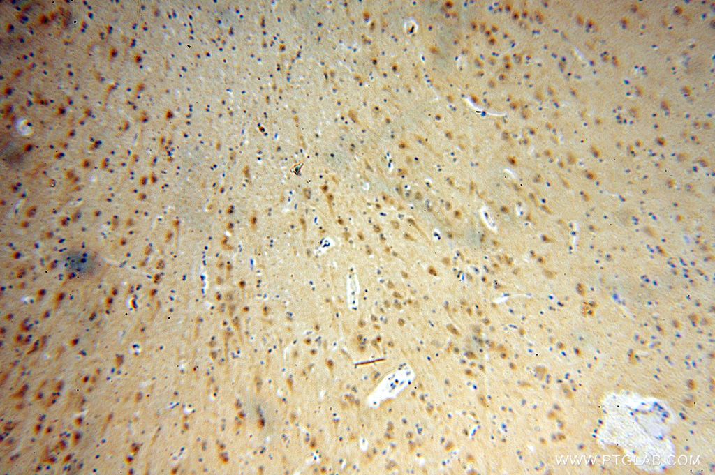 Immunohistochemistry (IHC) staining of human brain tissue using PTPN18 Polyclonal antibody (17551-1-AP)