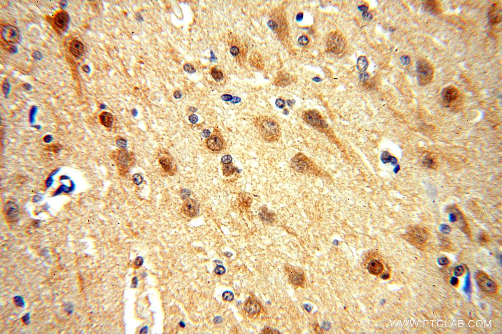 Immunohistochemistry (IHC) staining of human brain tissue using PTPN18 Polyclonal antibody (17551-1-AP)