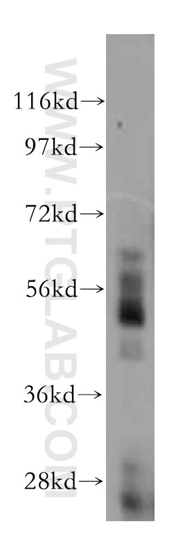 Western Blot (WB) analysis of human brain tissue using PTPN18 Polyclonal antibody (17551-1-AP)