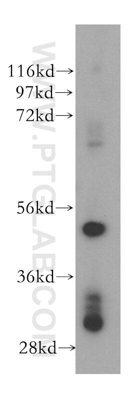Western Blot (WB) analysis of Jurkat cells using PTPN18 Polyclonal antibody (17551-1-AP)