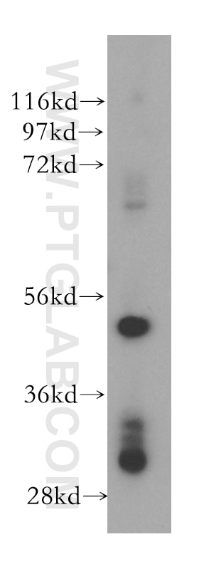WB analysis of Jurkat using 17551-1-AP