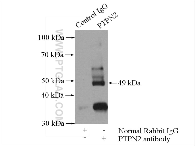 Immunoprecipitation (IP) experiment of HL-60 cells using PTPN2 Polyclonal antibody (11214-1-AP)