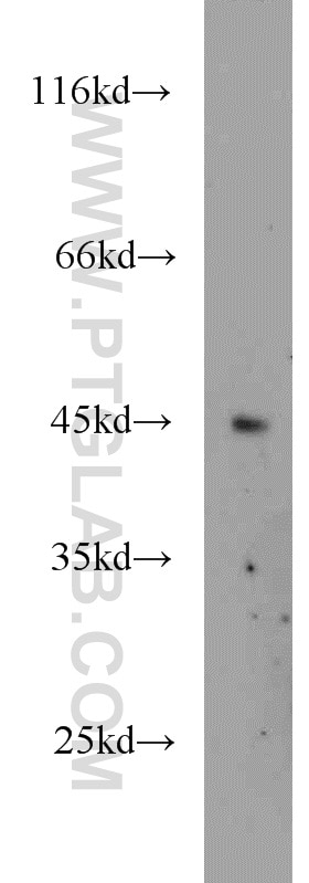 Western Blot (WB) analysis of HeLa cells using PTPN2 Polyclonal antibody (11214-1-AP)