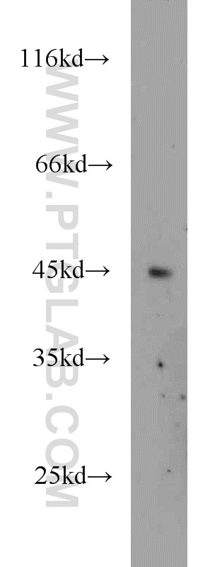 WB analysis of HeLa using 11214-1-AP