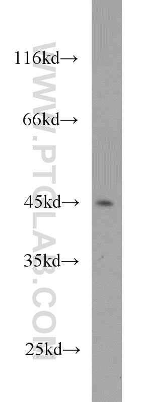 Western Blot (WB) analysis of HL-60 cells using PTPN2 Polyclonal antibody (11214-1-AP)