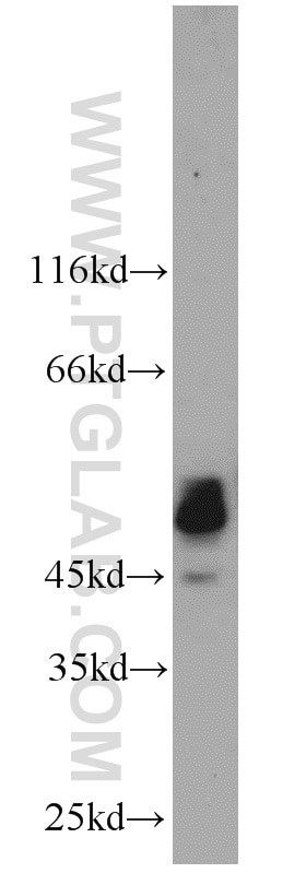 Western Blot (WB) analysis of mouse thymus tissue using PTPN2 Polyclonal antibody (11214-1-AP)