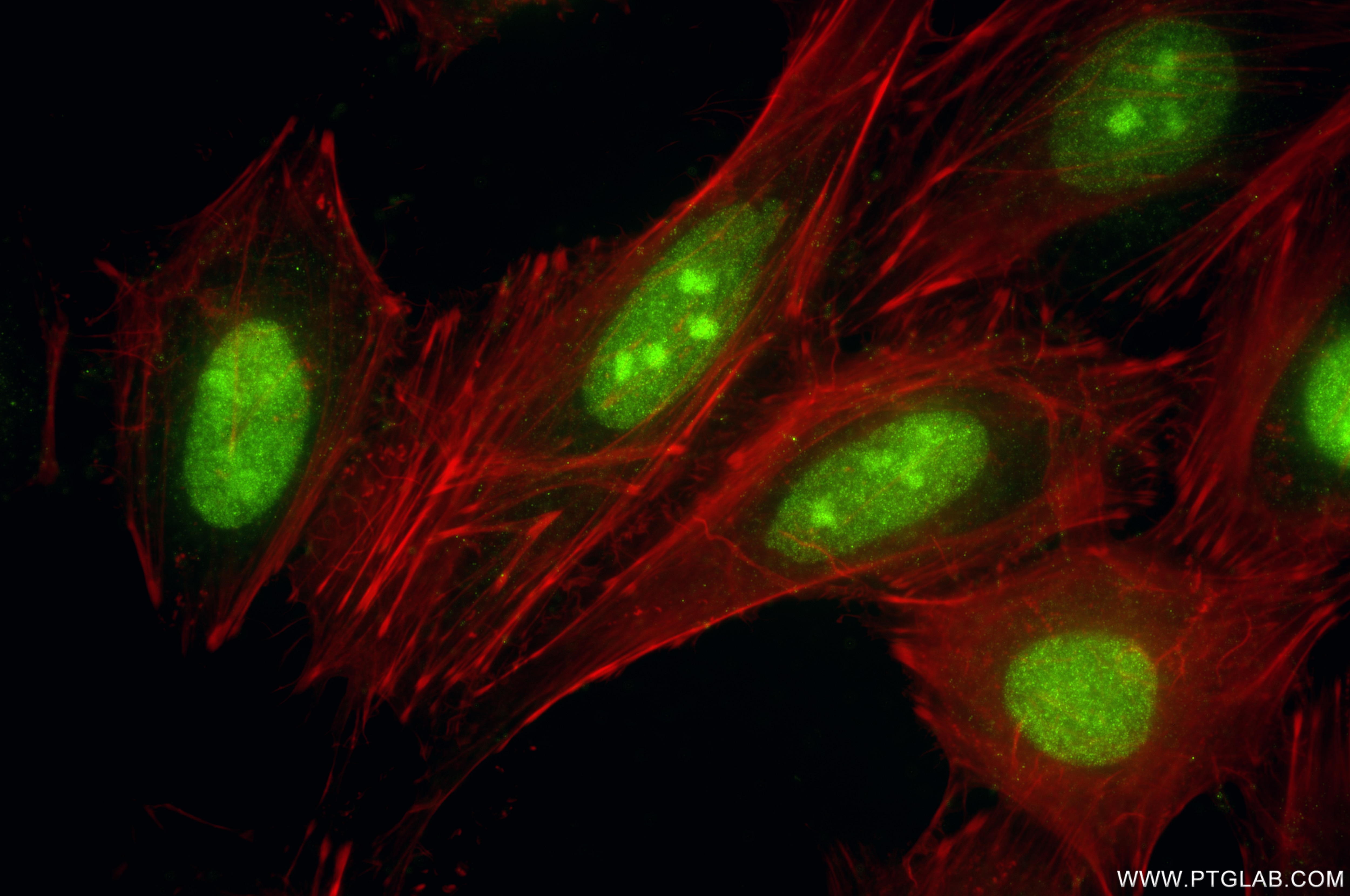 Immunofluorescence (IF) / fluorescent staining of HeLa cells using PTPN2 Recombinant antibody (85915-1-RR)