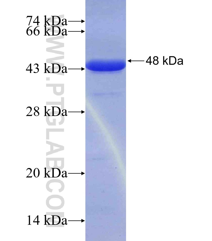 PTPN2 fusion protein Ag29749 SDS-PAGE