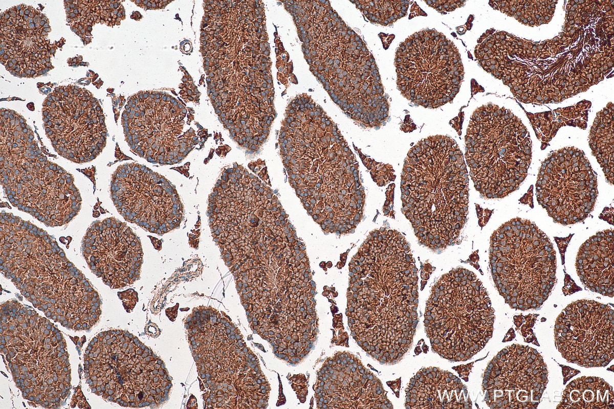Immunohistochemistry (IHC) staining of mouse testis tissue using PTPN20A Polyclonal antibody (25648-1-AP)