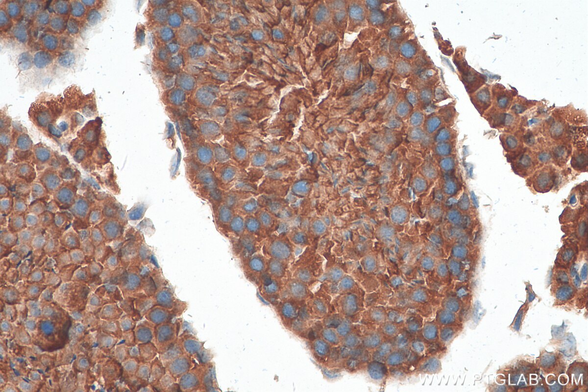 Immunohistochemistry (IHC) staining of mouse testis tissue using PTPN20A Polyclonal antibody (25648-1-AP)
