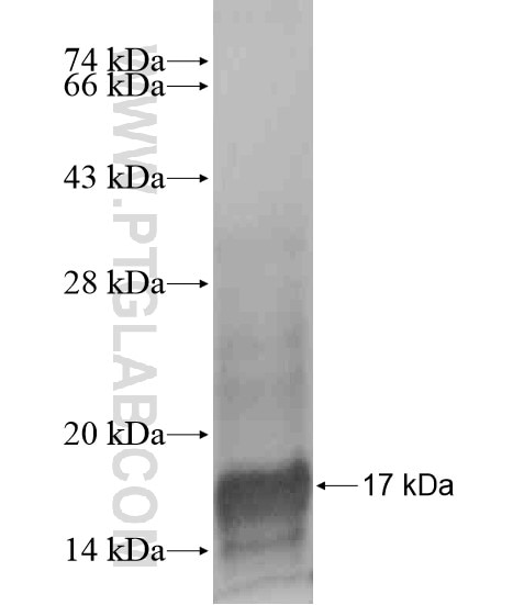 PTPN20A fusion protein Ag20790 SDS-PAGE