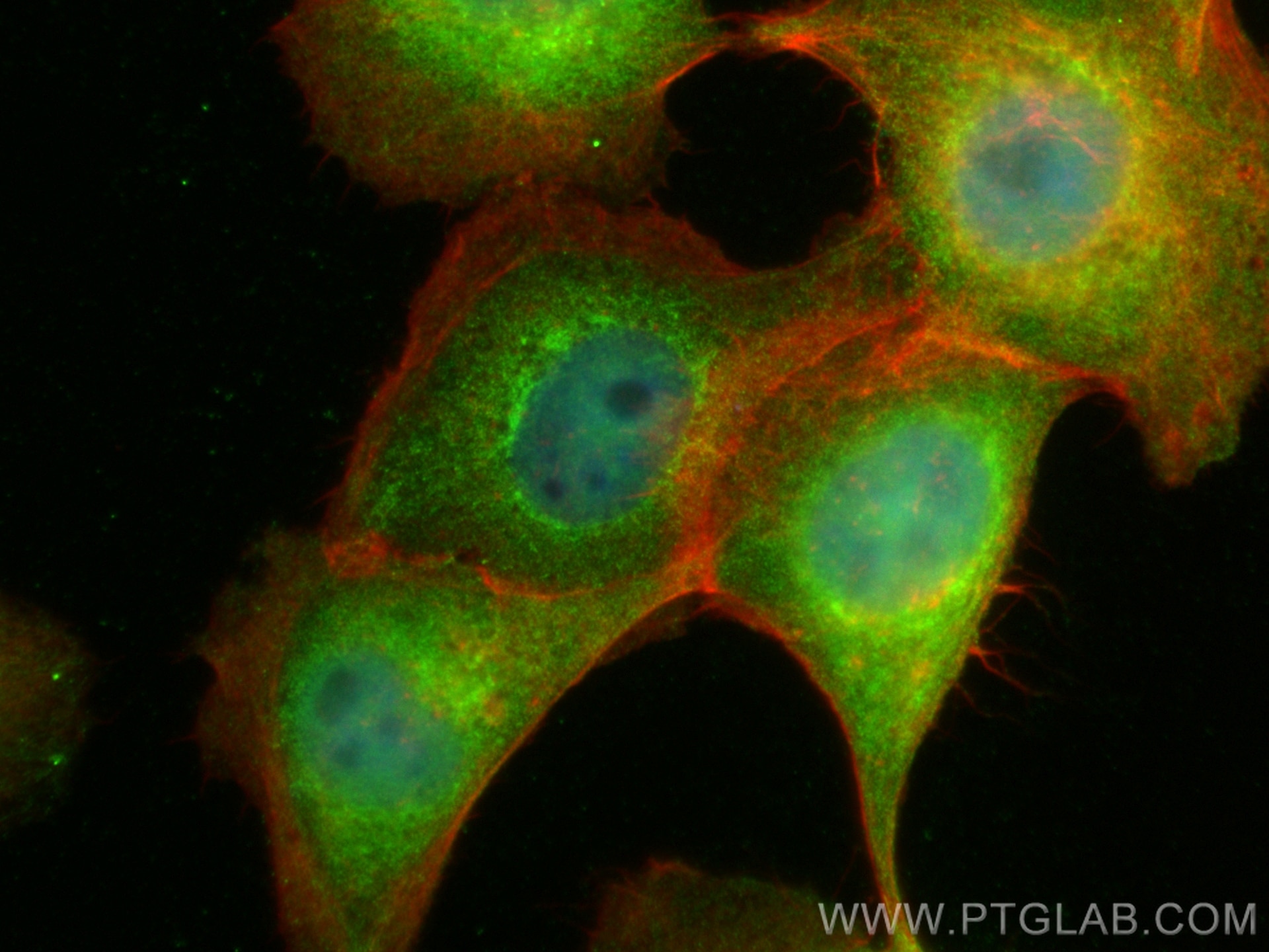 Immunofluorescence (IF) / fluorescent staining of A431 cells using PTPN20 Polyclonal antibody (19510-1-AP)