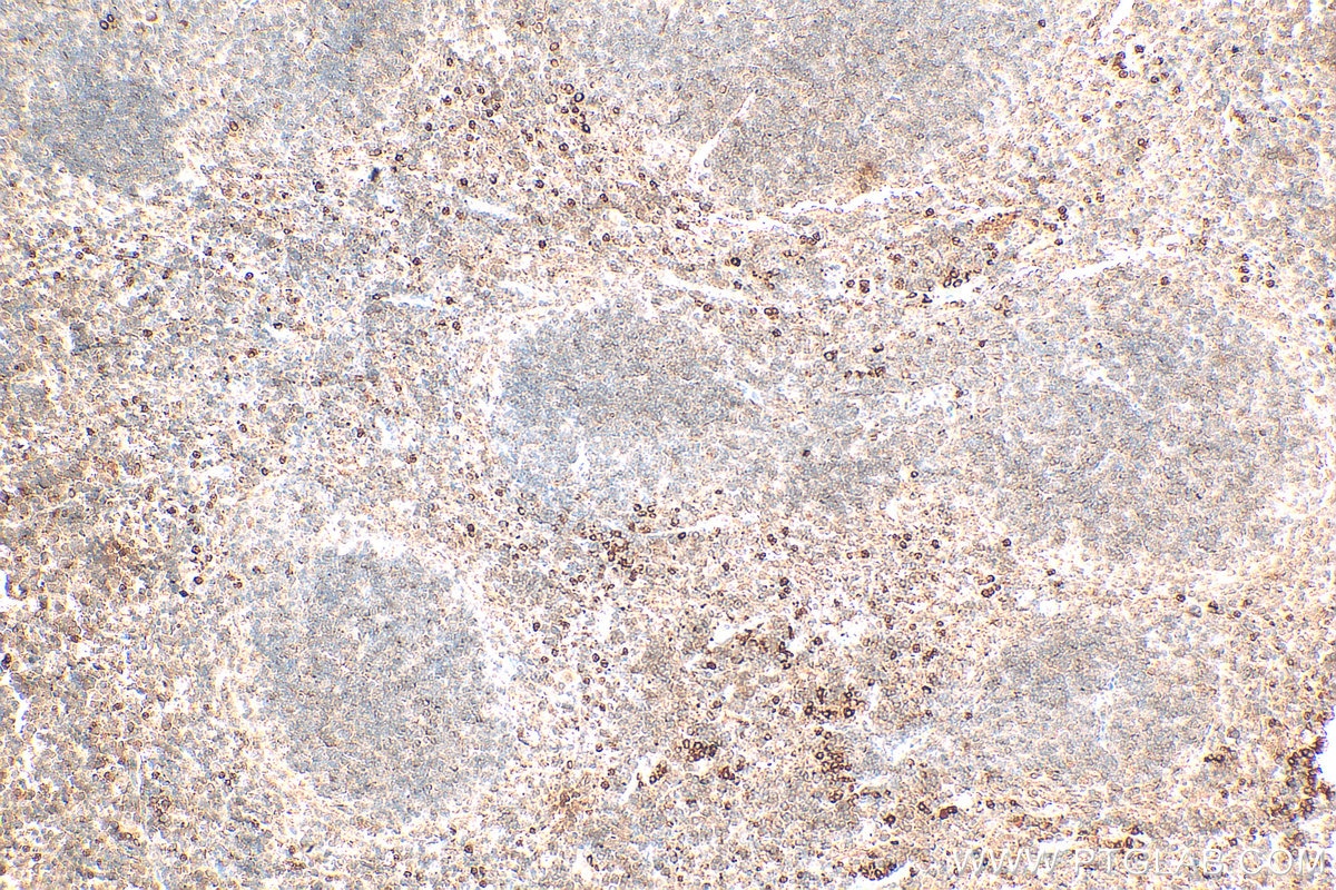 Immunohistochemistry (IHC) staining of mouse spleen tissue using PTPN20 Polyclonal antibody (19510-1-AP)