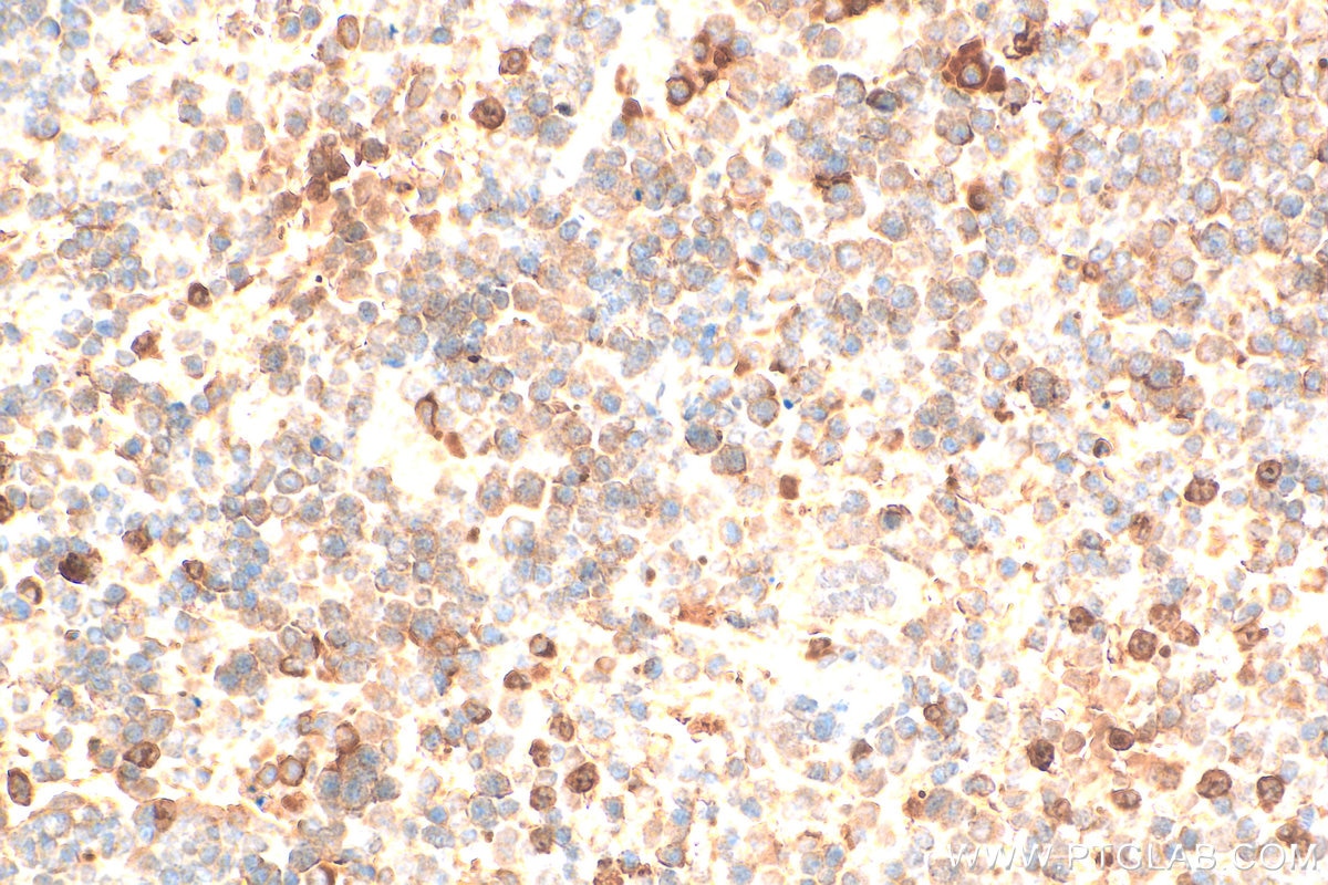 Immunohistochemistry (IHC) staining of mouse spleen tissue using PTPN20 Polyclonal antibody (19510-1-AP)
