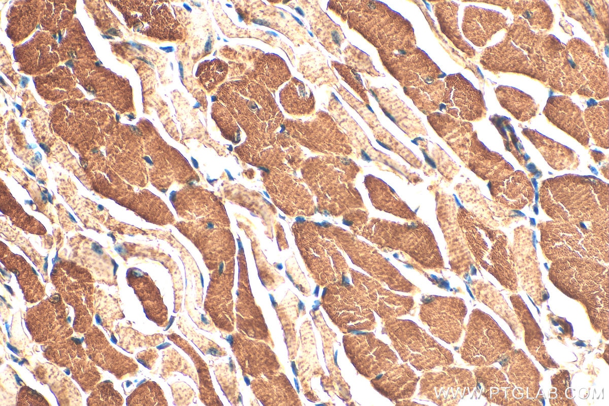 Immunohistochemistry (IHC) staining of mouse tongue tissue using PTPN20 Polyclonal antibody (19510-1-AP)
