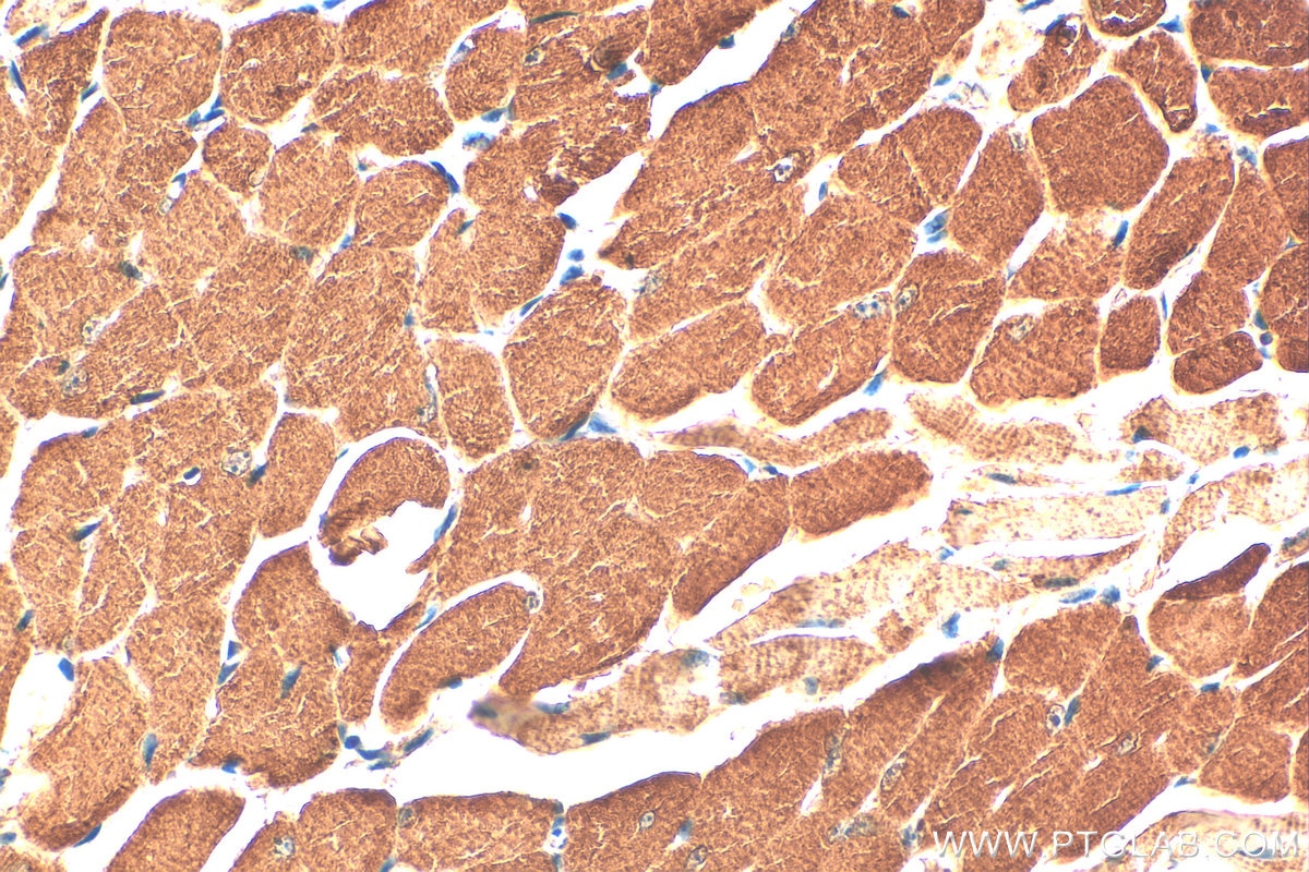 Immunohistochemistry (IHC) staining of mouse tongue tissue using PTPN20 Polyclonal antibody (19510-1-AP)