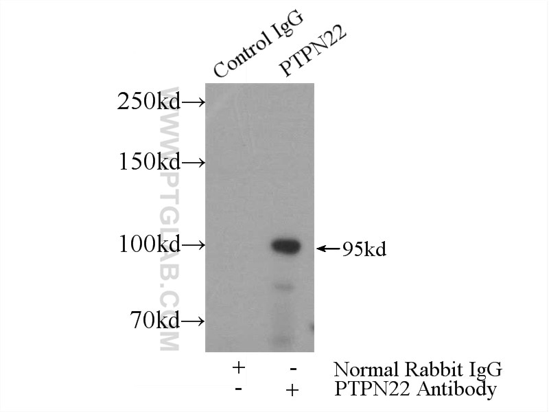 Immunoprecipitation (IP) experiment of Jurkat cells using PTPN22 Polyclonal antibody (11783-1-AP)