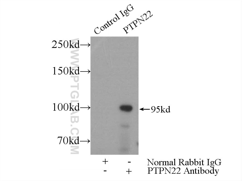 IP experiment of Jurkat using 11783-1-AP