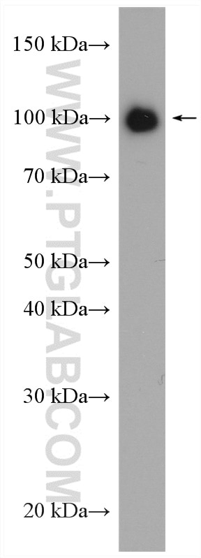 Western Blot (WB) analysis of Jurkat cells using PTPN22 Polyclonal antibody (11783-1-AP)