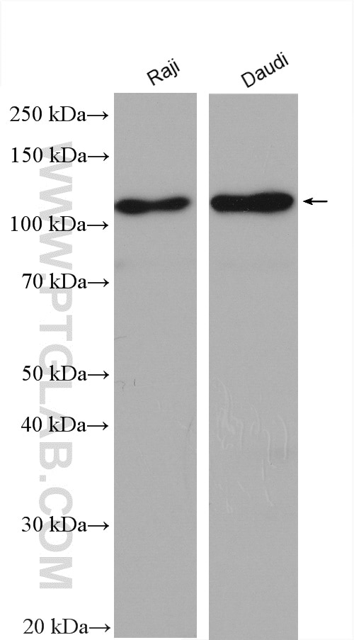 Western Blot (WB) analysis of various lysates using PTPN22 Polyclonal antibody (11783-1-AP)