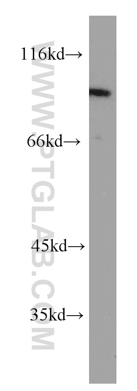 PTPN22 Polyclonal antibody