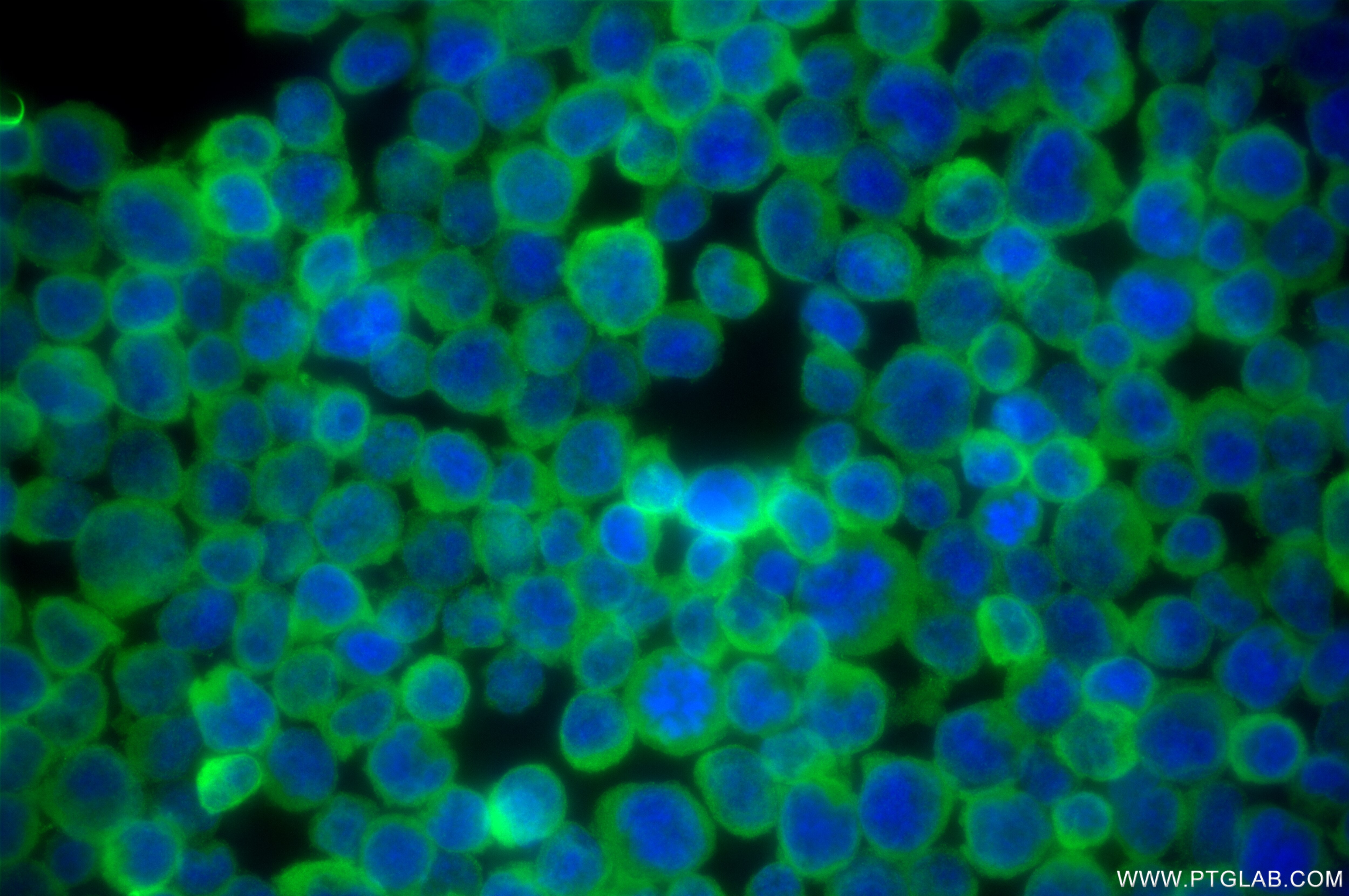 Immunofluorescence (IF) / fluorescent staining of Jurkat cells using PTPN22 Recombinant antibody (85062-4-RR)