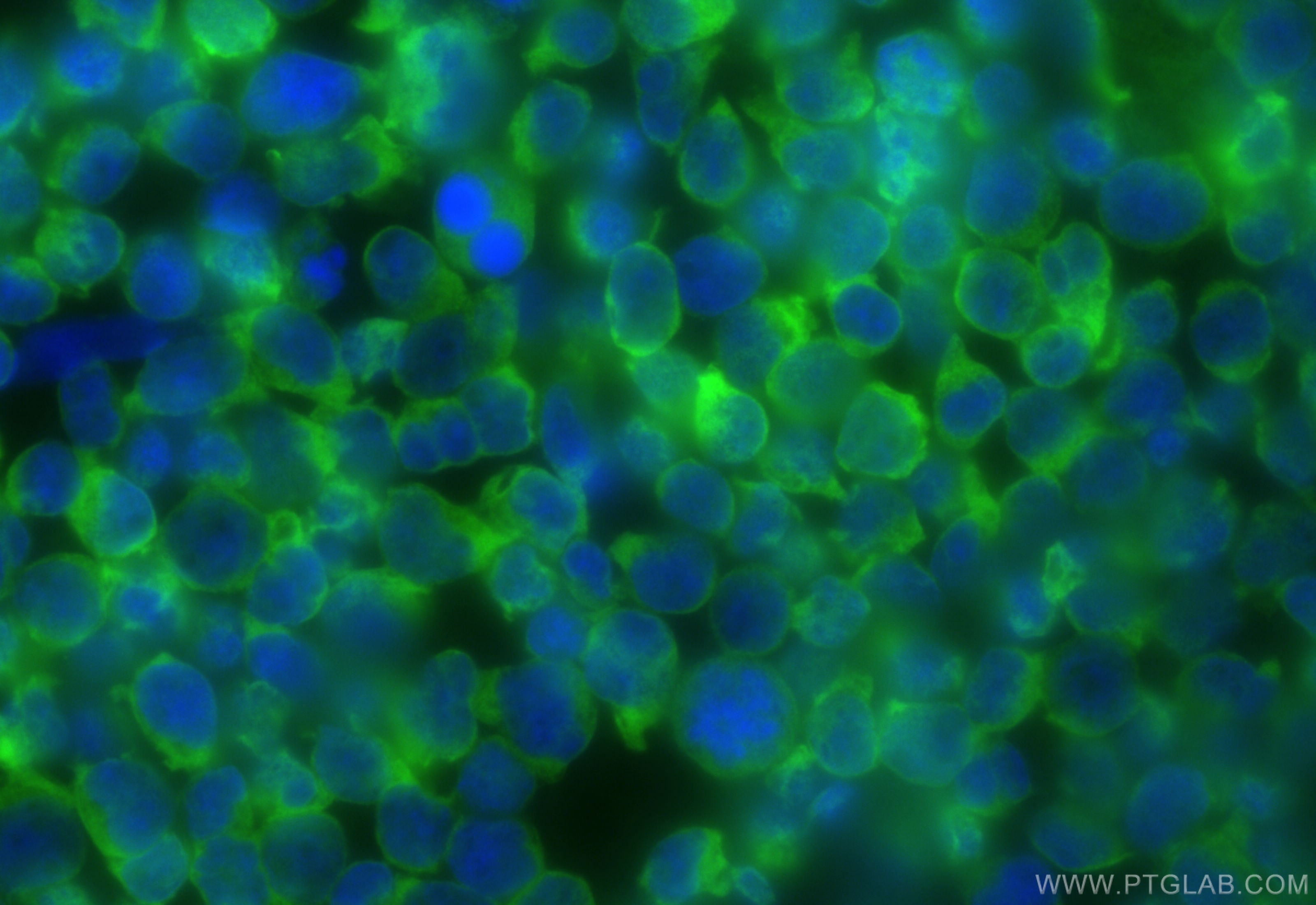 Immunofluorescence (IF) / fluorescent staining of Jurkat cells using CoraLite® Plus 488-conjugated PTPN22 Recombinant a (CL488-85062-4)