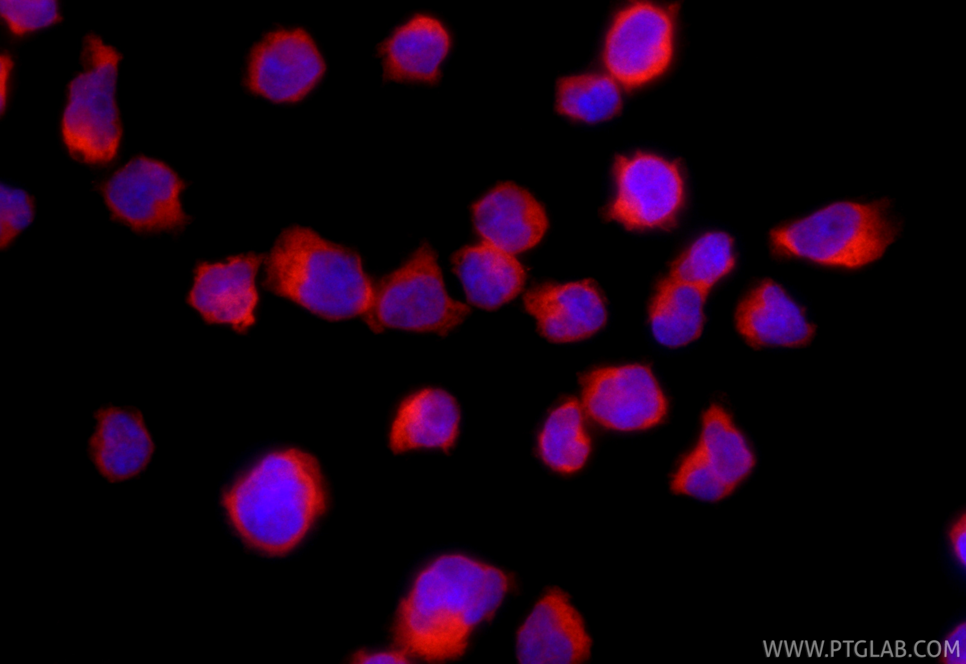 IF Staining of Jurkat using CL594-85062-4 Immunofluorescence (IF) / fluorescent staining of Jurkat cells using CoraLite®594-conjugated PTPN22 Recombinant monoclo (CL594-85062-4)