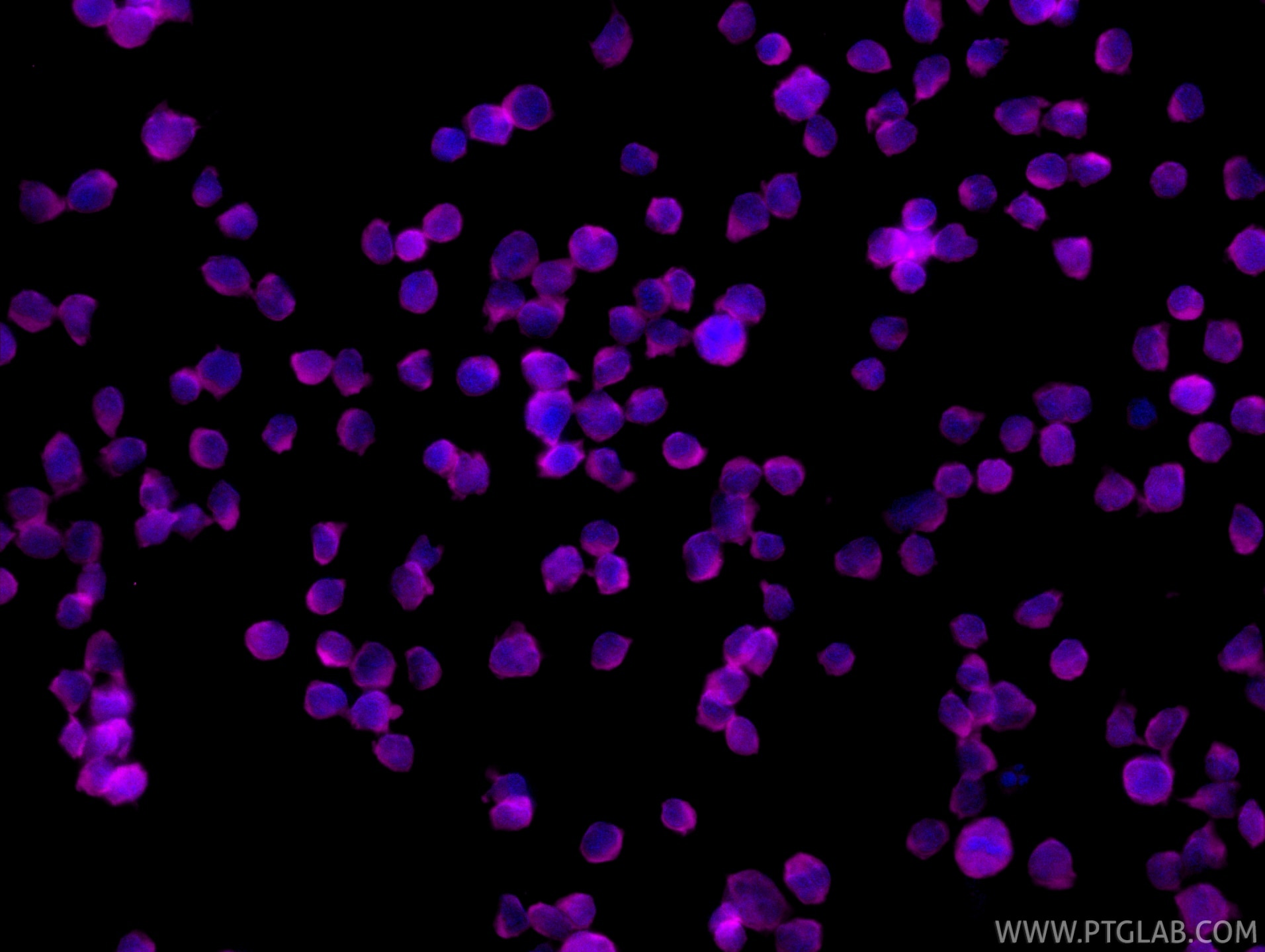IF Staining of Jurkat using CL647-85062-4 Immunofluorescence (IF) / fluorescent staining of Jurkat cells using CoraLite® Plus 647-conjugated PTPN22 Recombinant m (CL647-85062-4)