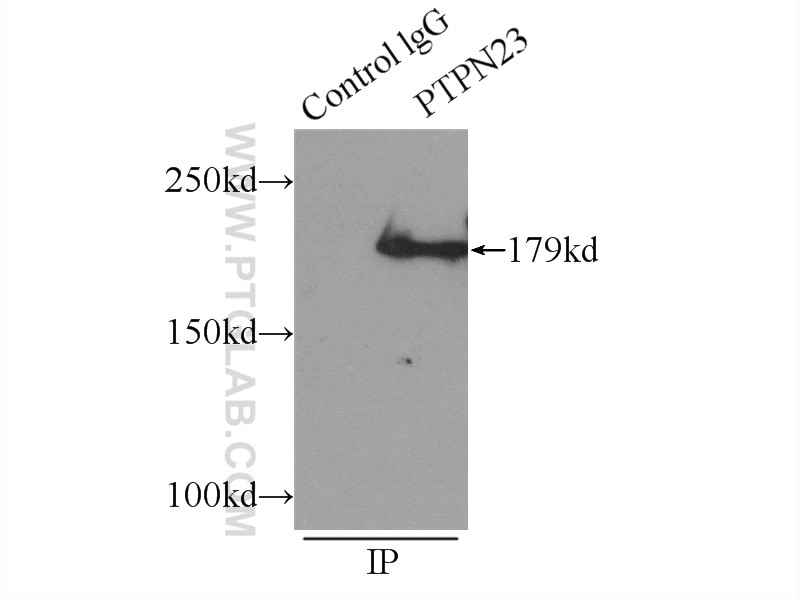 Immunoprecipitation (IP) experiment of HeLa cells using PTPN23 Polyclonal antibody (10472-1-AP)