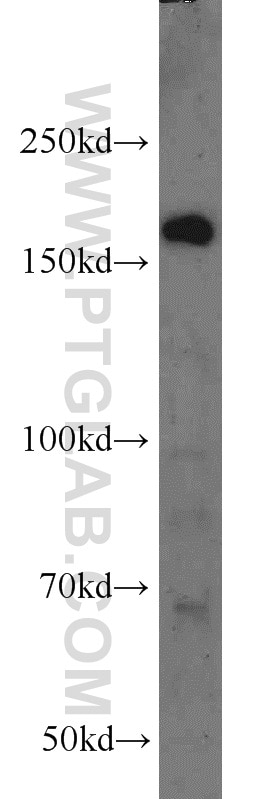 WB analysis of HeLa using 10472-1-AP