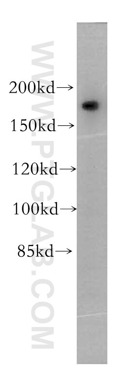 Western Blot (WB) analysis of A375 cells using PTPN23 Polyclonal antibody (10472-1-AP)