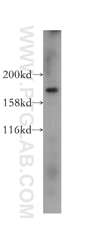 Western Blot (WB) analysis of HeLa cells using PTPN23 Polyclonal antibody (10472-1-AP)