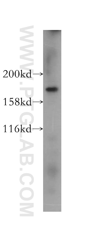 WB analysis of HeLa using 10472-1-AP