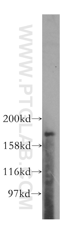 Western Blot (WB) analysis of A375 cells using PTPN23 Polyclonal antibody (10472-1-AP)