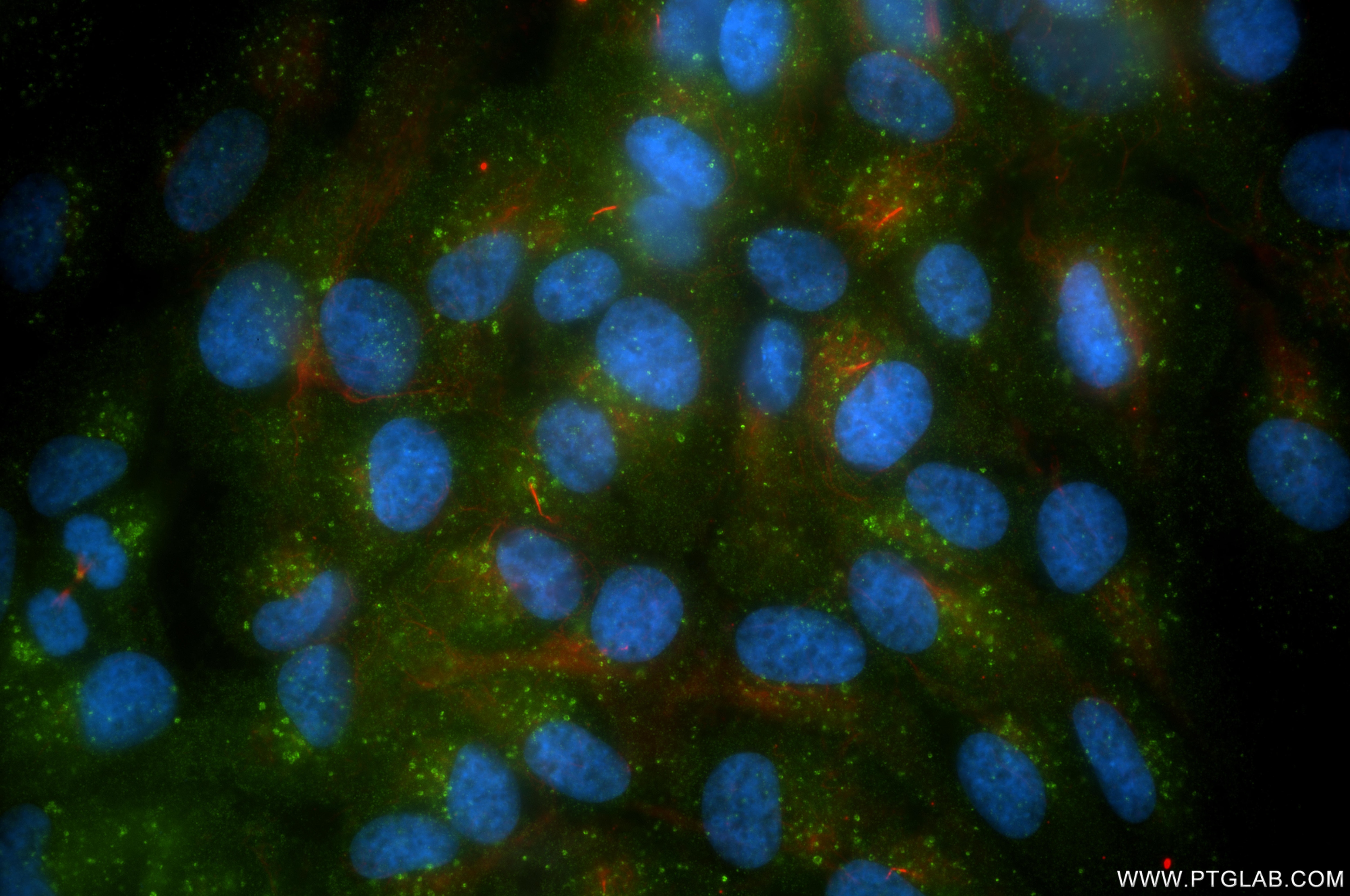 IF Staining of hTERT-RPE1 using 87561-1-RR Immunofluorescence (IF) / fluorescent staining of hTERT-RPE1 cells using PTPN23 Recombinant monoclonal antibody (87561-1-RR)