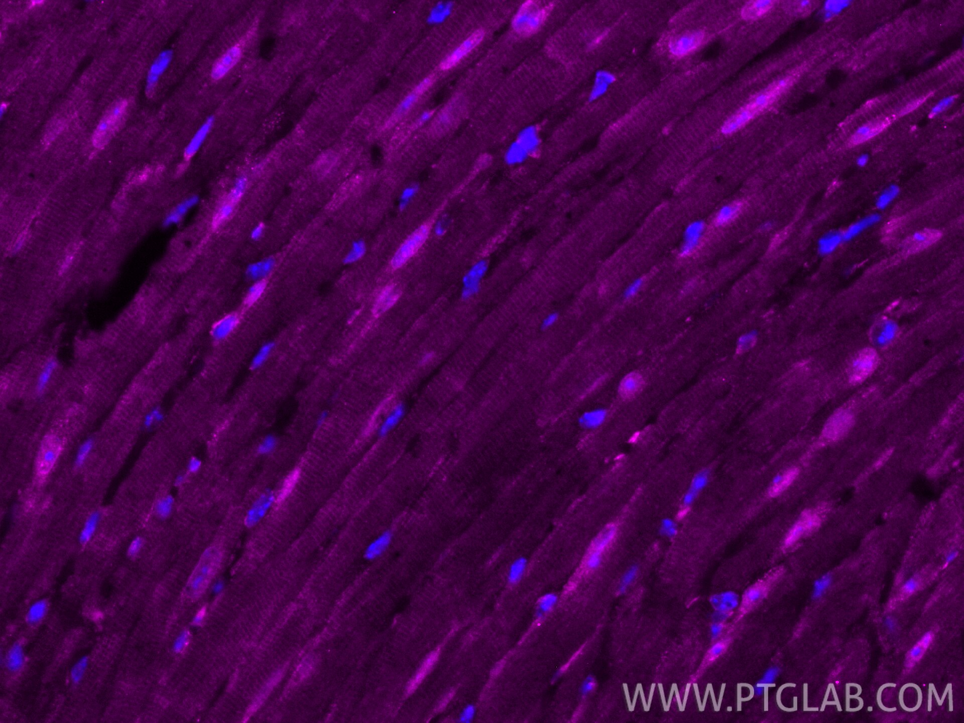 Immunofluorescent analysis of (4% PFA) fixed paraffin-embedded mouse heart tissue using CoraLite®647 PTPN23 antibody (CL647-10472) at dilution of 1:200. Heat mediated antigen retrieval with Tris-EDTA buffer (pH 9.0). Immunofluorescence (IF) / fluorescent staining of mouse heart tissue using CoraLite®647-conjugated PTPN23 Polyclonal antibody (CL647-10472)