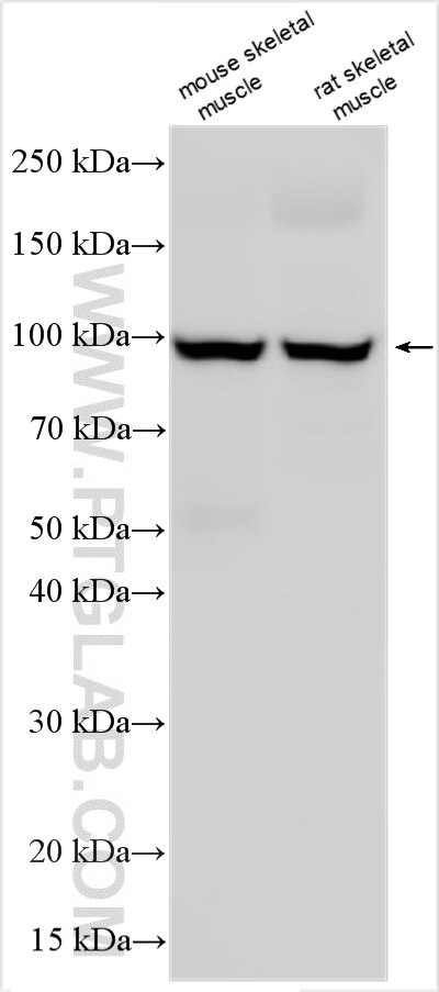 Western Blot (WB) analysis of various lysates using PTPN3-Specific Polyclonal antibody (19714-1-AP)