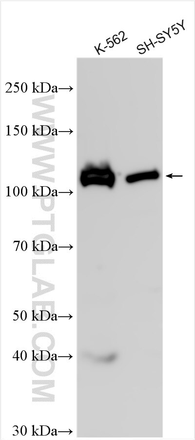 Western Blot (WB) analysis of various lysates using PTPN4 Polyclonal antibody (11131-1-AP)
