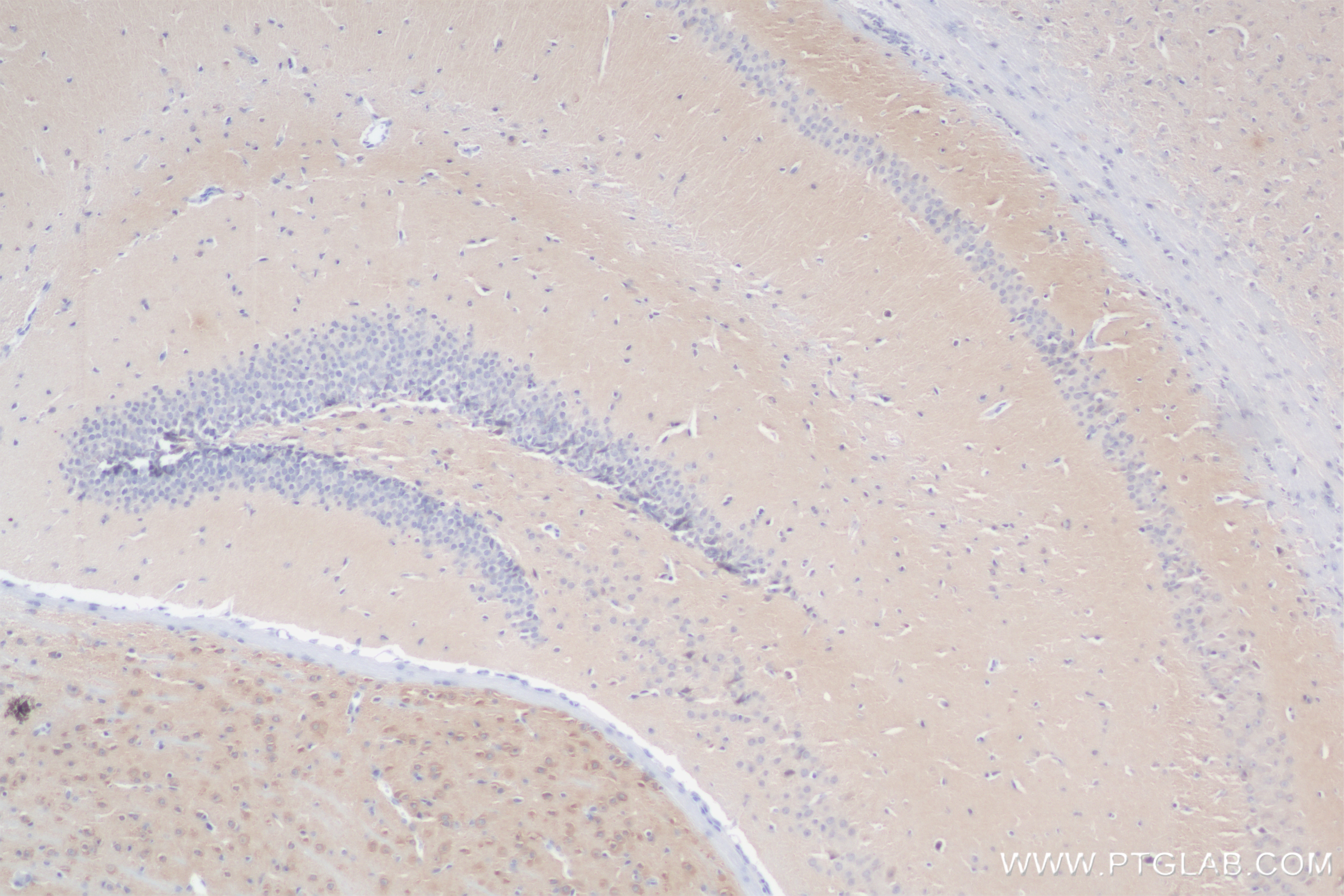 Immunohistochemical analysis of paraffin-embedded mouse brain tissue slide using 83695-1-RR (PTPN4 antibody) at dilution of 1:500 (under 10x lens). Heat mediated antigen retrieval with Tris-EDTA buffer (pH 9.0). Immunohistochemistry (IHC) staining of mouse brain tissue using PTPN4 Recombinant monoclonal antibody (83695-1-RR)