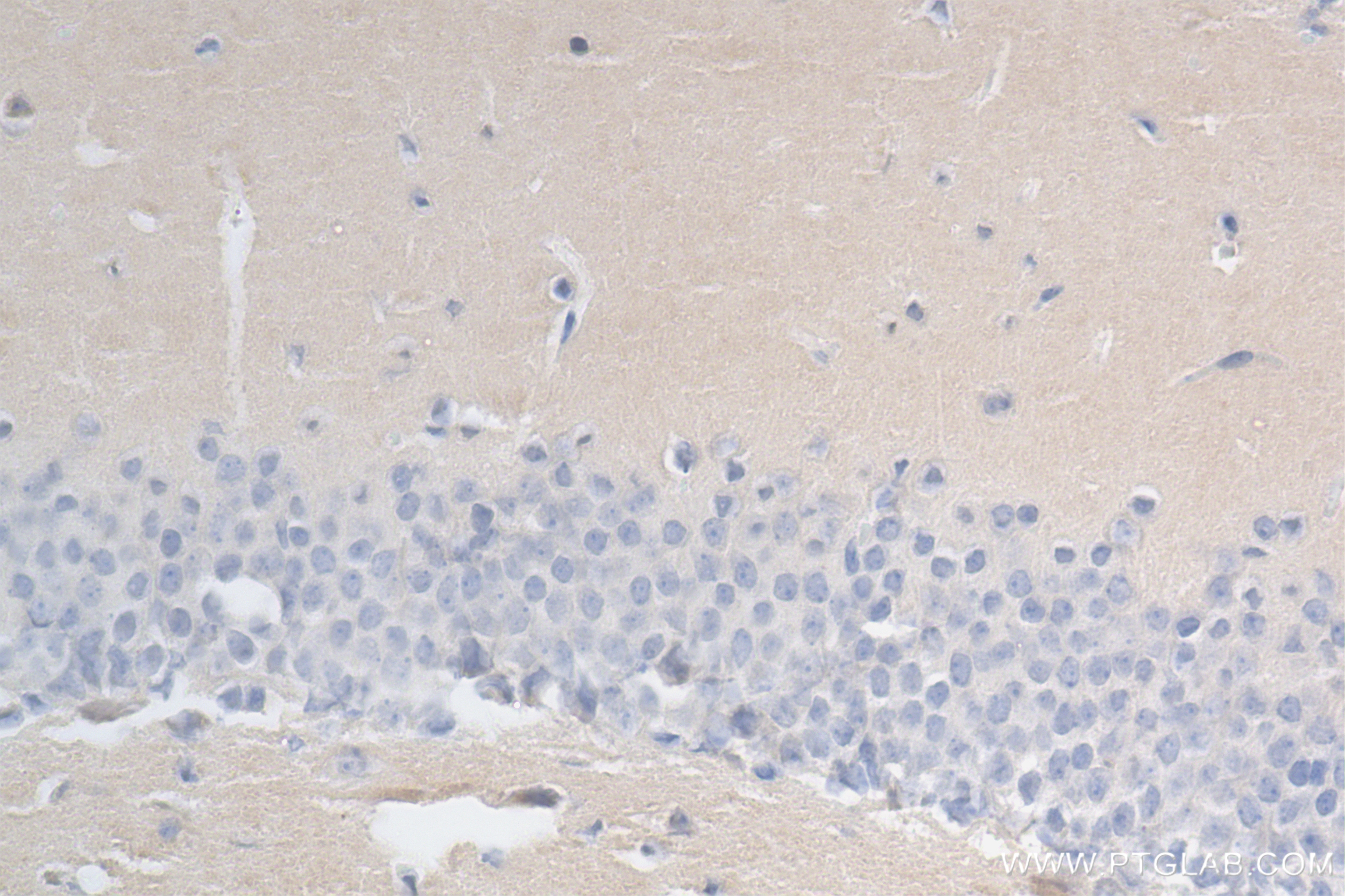 Immunohistochemistry (IHC) staining of mouse brain tissue using PTPN4 Recombinant monoclonal antibody (83695-1-RR)