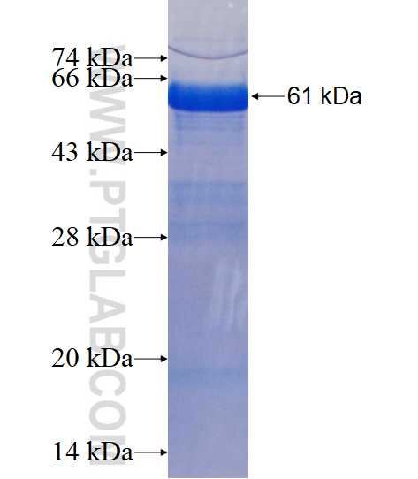 PTPN4 fusion protein Ag1585 SDS-PAGE